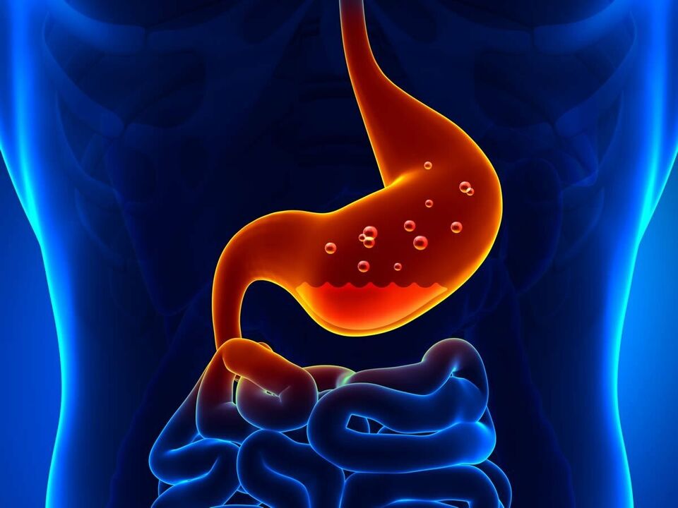 Gastritída je zápalové ochorenie žalúdka, ktoré si vyžaduje diétu